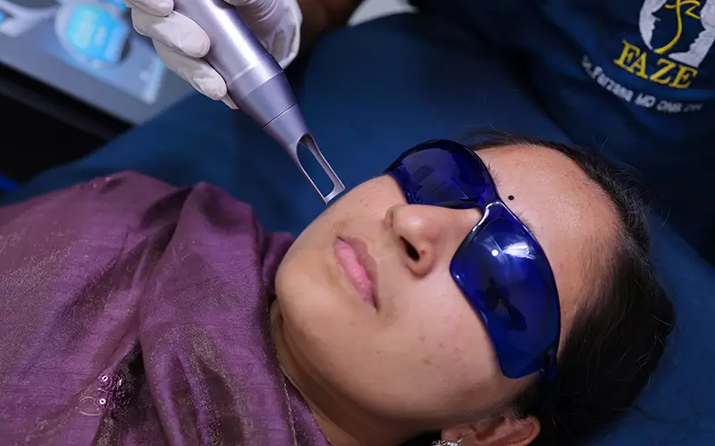 FAZE - Life Without Limits